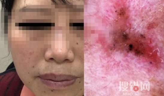 女子陪閨蜜就診自己卻被查出癌癥 檢查結果讓兩人同時大跌眼鏡