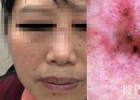女子陪閨蜜就診自己卻被查出癌癥 醫生一眼就看出來了