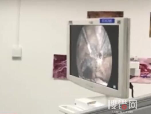 漂亮女子突然體重暴增變丑查出腦瘤 原因竟是這樣簡直太嚇人了
