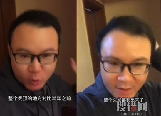 男子回應(yīng)“不用洗發(fā)水變滿頭黑發(fā)” 原因竟是這樣簡直太崩潰了