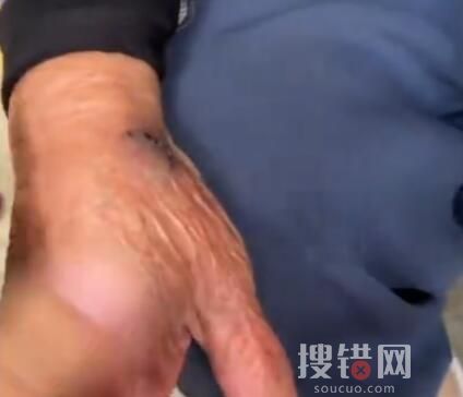 工作人員回應網紅獨臂猴咬傷師太 內幕曝光簡直太意外了
