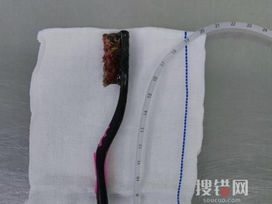 小伙清理舌苔誤吞18厘米長(zhǎng)牙刷 原因竟是這樣實(shí)在太驚險(xiǎn)