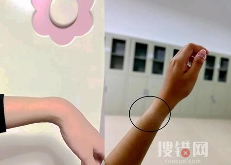 多人稱戴蘋果手表“手凹了” 背后真相簡直太驚人了
