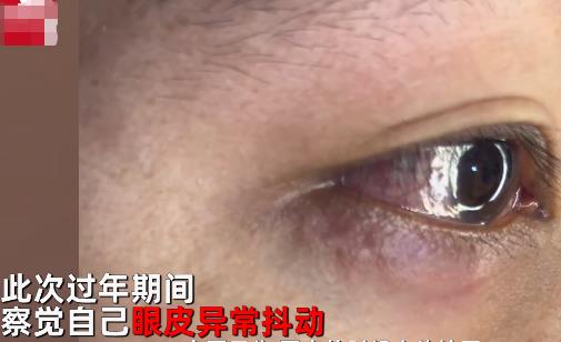 男子左眼皮異常抖動有蟲游走 眼皮上怎么會有蟲?