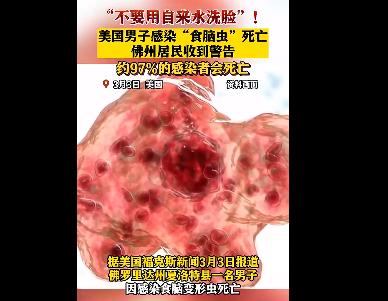 美國男子自來水洗臉感染食腦蟲死亡 真相揭露真的令人大吃一驚