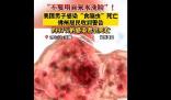 美國男子自來水洗臉感染食腦蟲死亡 真相揭露真的令人大吃一驚