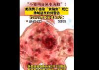 美國(guó)男子自來(lái)水洗臉感染食腦蟲(chóng)死亡 真相揭露真的令人大吃一驚