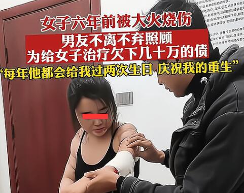 男子照顧大面積燒傷女友6年 真相揭露真的令人大吃一驚
