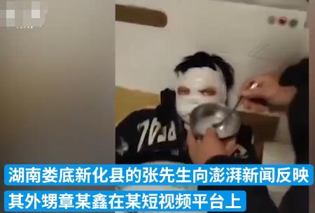 12歲男孩看短視頻學做火藥被炸傷 傷情嚴重臉被炸黑簡直太可憐了