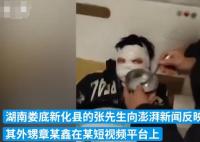 12歲男孩看短視頻學做火藥被炸傷 傷情嚴重臉被炸黑簡直太可憐了