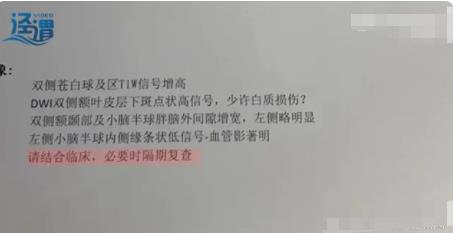 月嫂拍嗝時打盹致嬰兒頭頂骨骨折 真相曝光簡直太驚人了