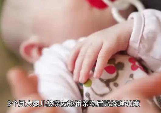 嬰兒被親友輪番親吻高燒近40度