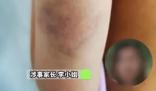 教師體罰學生被開除44名家長挽留 究竟是怎么回事？