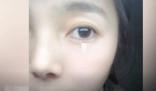 女子左眼瞳孔變大2倍找不到病因 原因實在太崩潰了