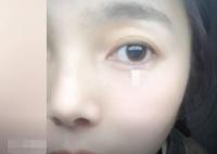 女子左眼瞳孔變大2倍找不到病因 究竟是怎么回事？