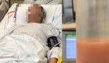 男子熬夜喝冰鎮飲料被送進ICU 原因竟是這樣太崩潰了