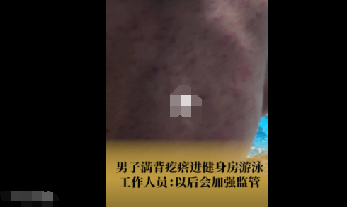 女子吐槽男子滿背疙瘩進泳池游泳 內幕曝光簡直太意外了