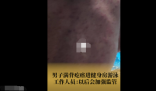 女子吐槽男子滿背疙瘩進泳池游泳 背后真相實在讓人驚愕