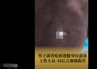 女子吐槽男子滿背疙瘩進泳池游泳 背后真相實在讓人驚愕