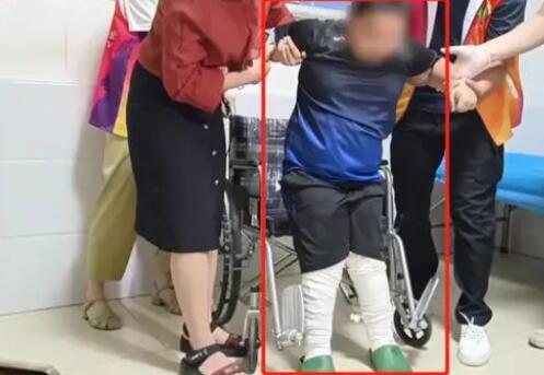 9歲馬蹄足男孩術后站起來了 真相曝光簡直太驚人了