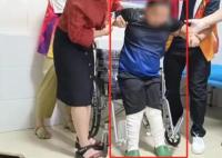 9歲馬蹄足男孩術后站起來了 真相曝光簡直太驚人了