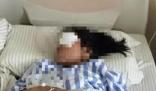 兩少年射瞎女童左眼逃離 警方不立案 背后原因簡直驚呆了眾人
