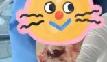 奶奶向3歲男童鼻腔塞頭發止血 背后原因簡直驚呆了眾人