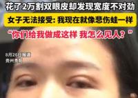 女子花2萬(wàn)割雙眼皮控訴成了悲傷蛙 到底是什么情況？