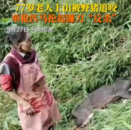 77歲老太被野豬咬傷后將其反殺 背后真相實在讓人驚愕