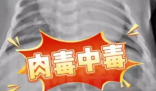 52天嬰兒喝奶奶喂的蜂蜜水中毒進ICU 事件始末2025最新消息