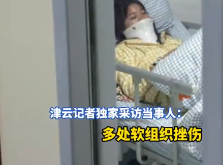 女子被追尾 第二天發現5根肋骨骨折 始料未及真相簡直太意外了