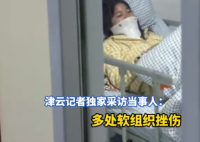 女子被追尾 第二天發現5根肋骨骨折 始料未及真相簡直太意外了
