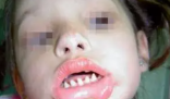 長哪吒同款鯊魚牙可能患有罕見病 背后真相實在讓人驚愕