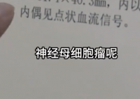 女孩因個(gè)矮去體檢發(fā)現(xiàn)腎上長腫瘤 事件始末2025最新消息
