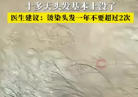 男子一月染頭4次致頭發大量脫落 內幕實在讓人驚個呆