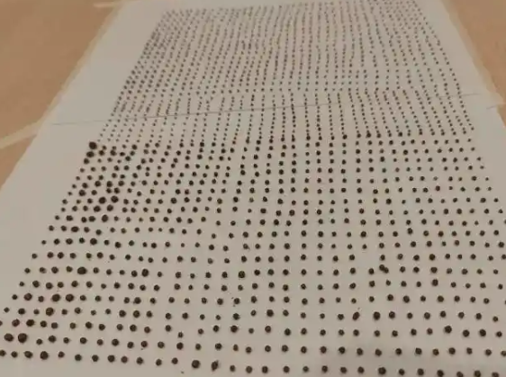 64歲大爺體內取出1791顆結石 始料未及真相簡直太意外了