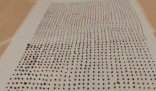 64歲大爺體內取出1791顆結石 始料未及真相簡直太意外了