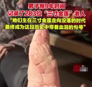 男子用9年時間記錄了283位裹腳老人 背后真相實在讓人驚愕