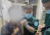 山西小伙脖子被扎多根燒烤簽 這也太可怕了