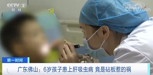6歲孩子患上“肝吸蟲病”！致病“元兇”竟是這個壞習慣