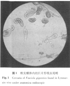 生吃水產(chǎn)會感染寄生蟲？
