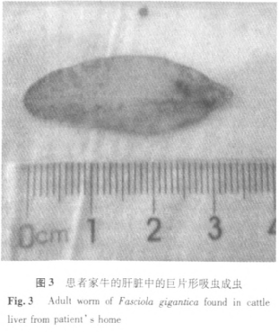 生吃水產(chǎn)會感染寄生蟲？